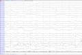 EEG of the month 1(source).png